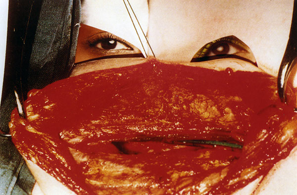 surgicalmasksmall