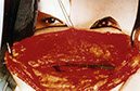 surgicalmasksmall